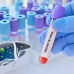 Brasil e a Meta Ambiciosa: É Realista Eliminar as Hepatites até 2030?