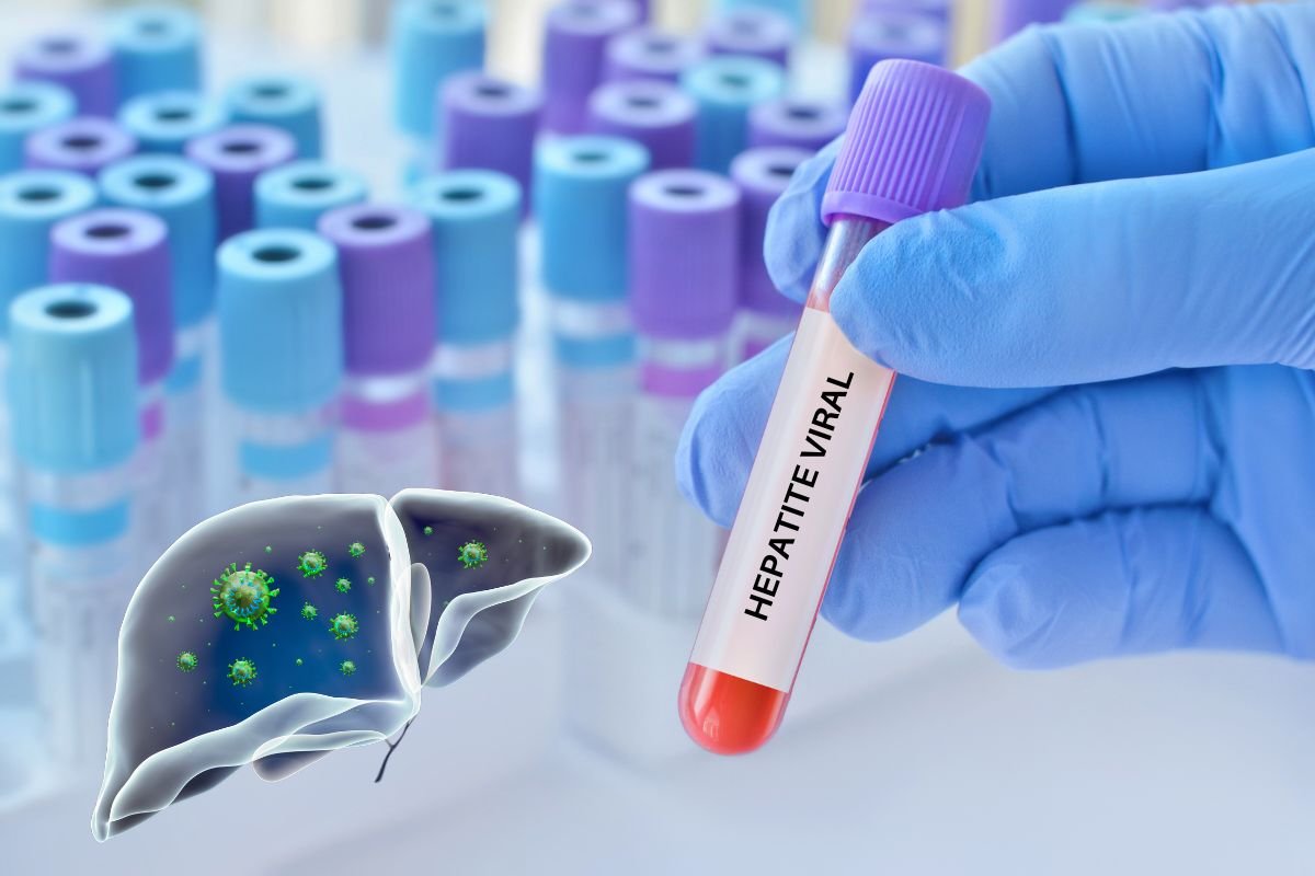 Brasil e a Meta Ambiciosa: É Realista Eliminar as Hepatites até 2030?